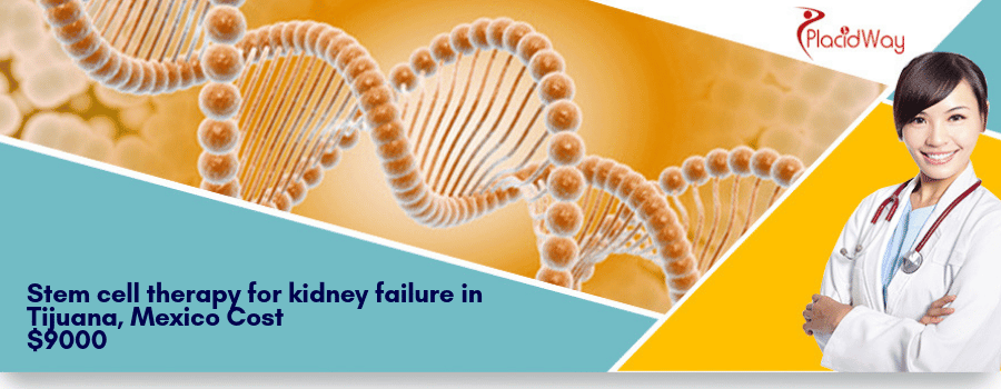 Stem Cell Therapy Cost for Kidney failure in Tijuana, Mexico